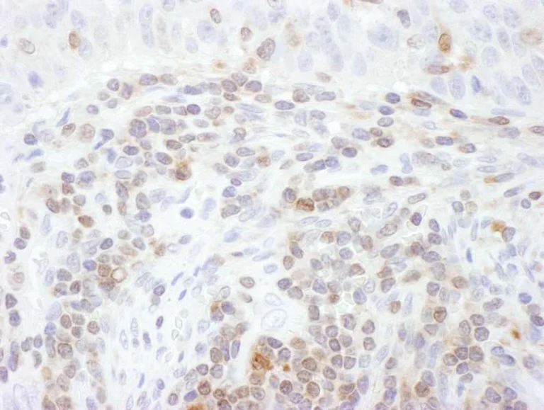 Immunohistochemistry (Formalin/PFA-fixed paraffin-embedded sections) - Anti-STAT5a antibody (AB264324)