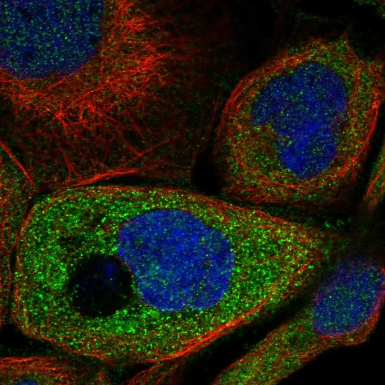 Immunocytochemistry/ Immunofluorescence - Anti-STAT5A Antibody (AB327212)