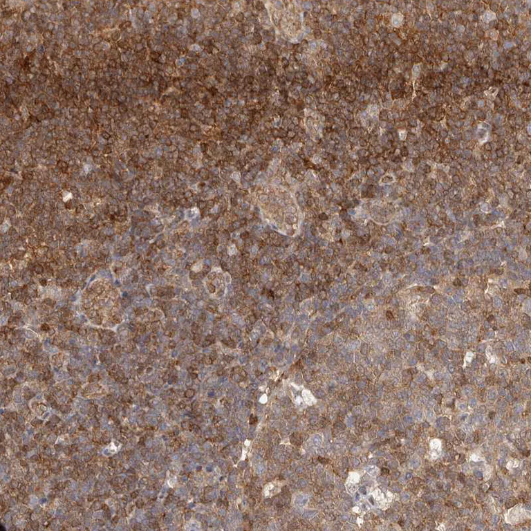 Immunohistochemistry (Formalin/PFA-fixed paraffin-embedded sections) - Anti-STAT5A Antibody (AB327212)