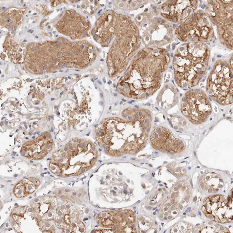 Immunohistochemistry (Formalin/PFA-fixed paraffin-embedded sections) - Anti-STAT5A Antibody (AB327212)
