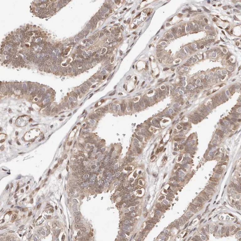 Immunohistochemistry (Formalin/PFA-fixed paraffin-embedded sections) - Anti-STAT5A Antibody (AB327212)