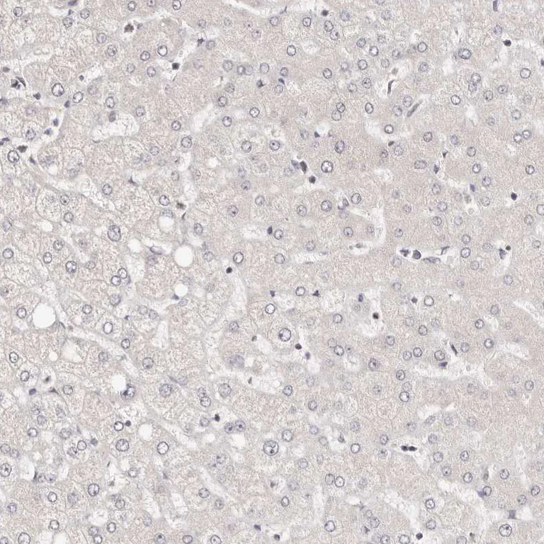 Immunohistochemistry (Formalin/PFA-fixed paraffin-embedded sections) - Anti-STAT5A Antibody (AB327212)