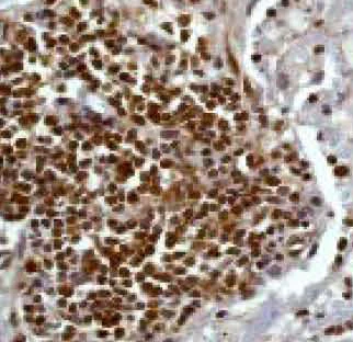 Immunohistochemistry (Formalin/PFA-fixed paraffin-embedded sections) - Anti-STAT5a antibody [E289] (AB32043)