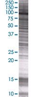 STAT5a overexpression 293T lysate (whole cell)