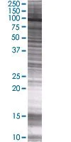 SDS-PAGE - STAT5a overexpression 293T lysate (whole cell) (AB94124)