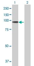 Western blot - STAT5a overexpression 293T lysate (whole cell) (AB94124)