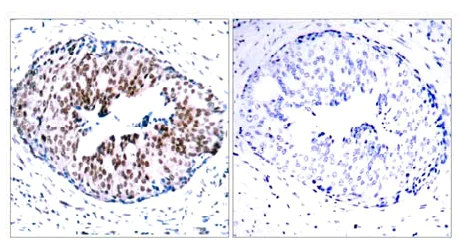 Immunohistochemistry (Formalin/PFA-fixed paraffin-embedded sections) - Anti-STAT5a (phospho S780) antibody (AB30649)