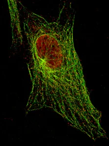 Immunocytochemistry/ Immunofluorescence - Anti-STAT5a (phospho Y694) antibody [6.F1] (AB106095)