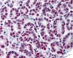 Immunohistochemistry (Formalin/PFA-fixed paraffin-embedded sections) - Anti-STAT5a (phospho Y694) antibody [6.F1] (AB106095)