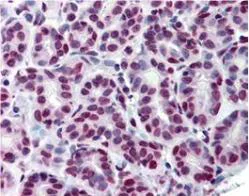 Immunohistochemistry (Formalin/PFA-fixed paraffin-embedded sections) - Anti-STAT5a (phospho Y694) antibody [6.F1] (AB106095)