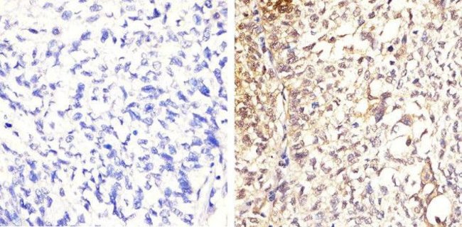 Immunohistochemistry (Formalin/PFA-fixed paraffin-embedded sections) - Anti-STAT5a (phospho Y694) antibody [6HCLC] (AB277762)