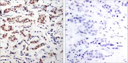 Immunohistochemistry (Formalin/PFA-fixed paraffin-embedded sections) - Anti-STAT5a (phospho Y694) antibody (AB30648)