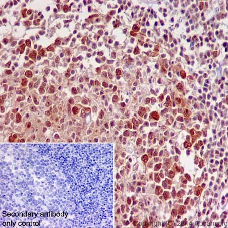 Immunohistochemistry (Formalin/PFA-fixed paraffin-embedded sections) - Anti-STAT5a + STAT5b antibody [EPR16668] (AB200341)