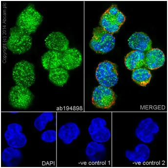 Immunocytochemistry/ Immunofluorescence - Anti-STAT5a + STAT5b antibody [EPR16671-40] - BSA and Azide free (AB215367)