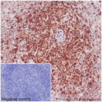 Immunohistochemistry (Formalin/PFA-fixed paraffin-embedded sections) - Anti-STAT5a + STAT5b antibody [EPR16671-40] - BSA and Azide free (AB215367)