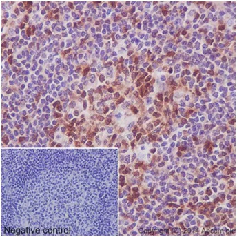 Immunohistochemistry (Formalin/PFA-fixed paraffin-embedded sections) - Anti-STAT5a + STAT5b antibody [EPR16671-40] - BSA and Azide free (AB215367)