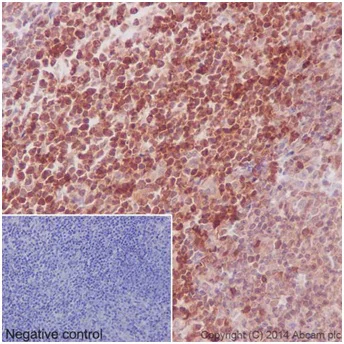 Immunohistochemistry (Formalin/PFA-fixed paraffin-embedded sections) - Anti-STAT5a + STAT5b antibody [EPR16671-40] - BSA and Azide free (AB215367)