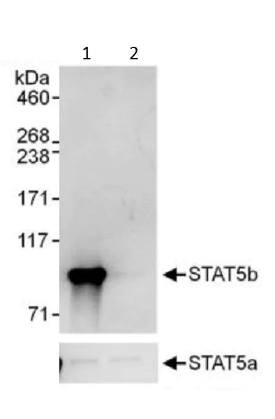 Immunoprecipitation - Anti-STAT5b antibody (AB226193)