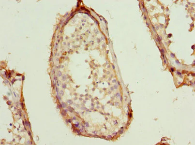 Immunohistochemistry (Formalin/PFA-fixed paraffin-embedded sections) - Anti-STAT5b antibody (AB235934)