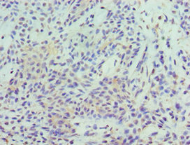 Immunohistochemistry (Formalin/PFA-fixed paraffin-embedded sections) - Anti-STAT5b antibody (AB235934)