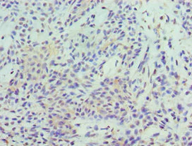 Immunohistochemistry (Formalin/PFA-fixed paraffin-embedded sections) - Anti-STAT5b antibody (AB235934)