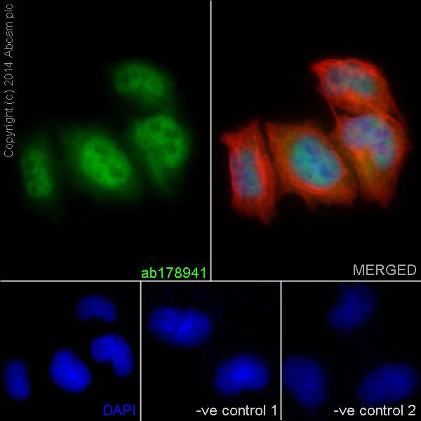 Immunocytochemistry/ Immunofluorescence - Anti-STAT5b antibody [EPR16671] - BSA and Azide free (AB240211)