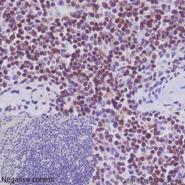 Immunohistochemistry (Formalin/PFA-fixed paraffin-embedded sections) - Anti-STAT5b antibody [EPR16671] - BSA and Azide free (AB240211)