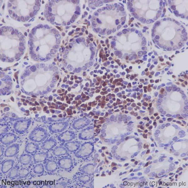 Immunohistochemistry (Formalin/PFA-fixed paraffin-embedded sections) - Anti-STAT5b antibody [EPR16671] - BSA and Azide free (AB240211)