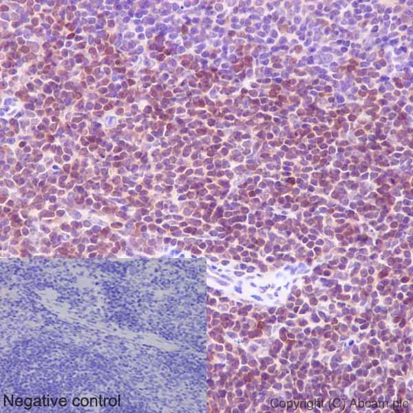 Immunohistochemistry (Formalin/PFA-fixed paraffin-embedded sections) - Anti-STAT5b antibody [EPR16671] - BSA and Azide free (AB240211)