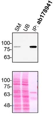 Immunoprecipitation - Anti-STAT5b antibody [EPR16671] - BSA and Azide free (AB240211)