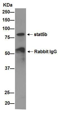 Immunoprecipitation - Anti-STAT5b antibody [EPR16671] - BSA and Azide free (AB240211)