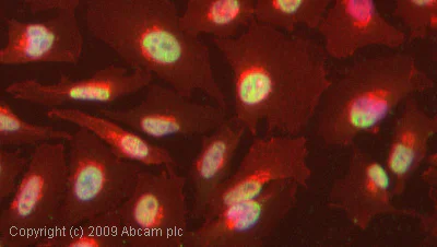 Immunocytochemistry/ Immunofluorescence - Anti-STAT5b (phospho S731) antibody (AB52211)