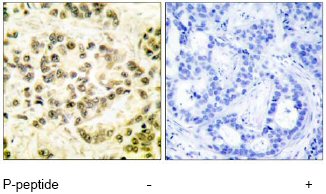 Immunohistochemistry (Formalin/PFA-fixed paraffin-embedded sections) - Anti-STAT5b (phospho S731) antibody (AB52211), expandable thumbnail