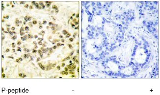 Immunohistochemistry (Formalin/PFA-fixed paraffin-embedded sections) - Anti-STAT5b (phospho S731) antibody (AB52211)