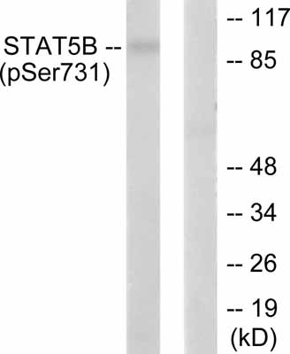 Western blot - Anti-STAT5b (phospho S731) antibody (AB52211), expandable thumbnail