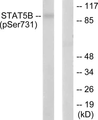 Western blot - Anti-STAT5b (phospho S731) antibody (AB52211)