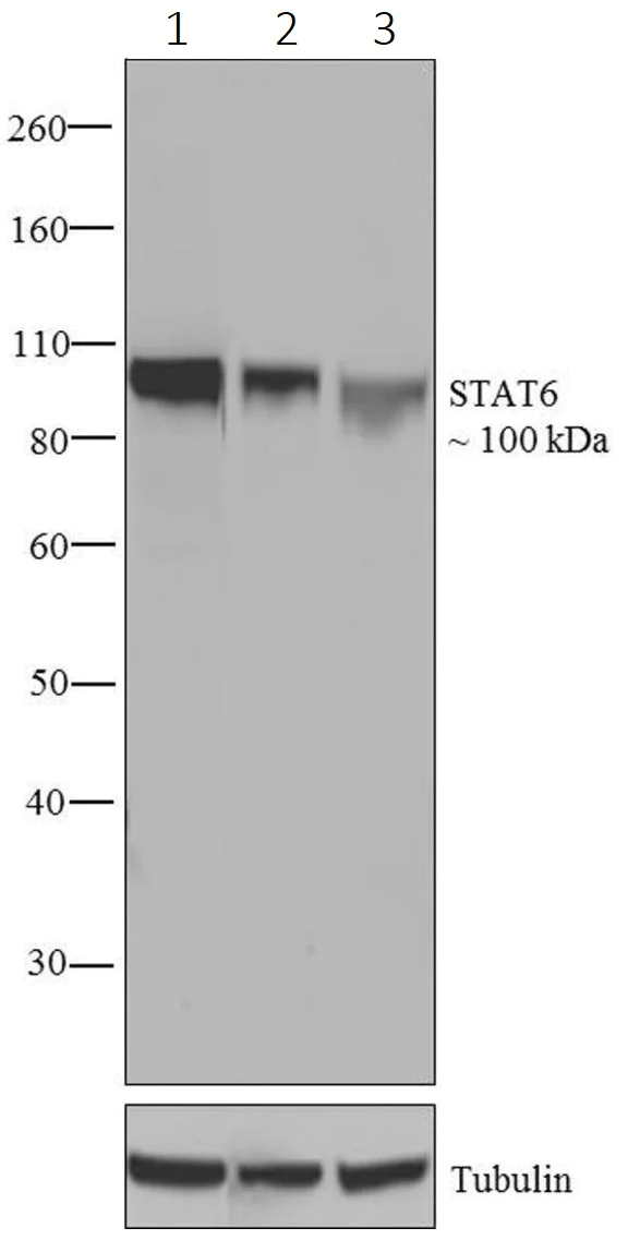 Western blot - Anti-STAT6 antibody [21HCLC] (AB277765)