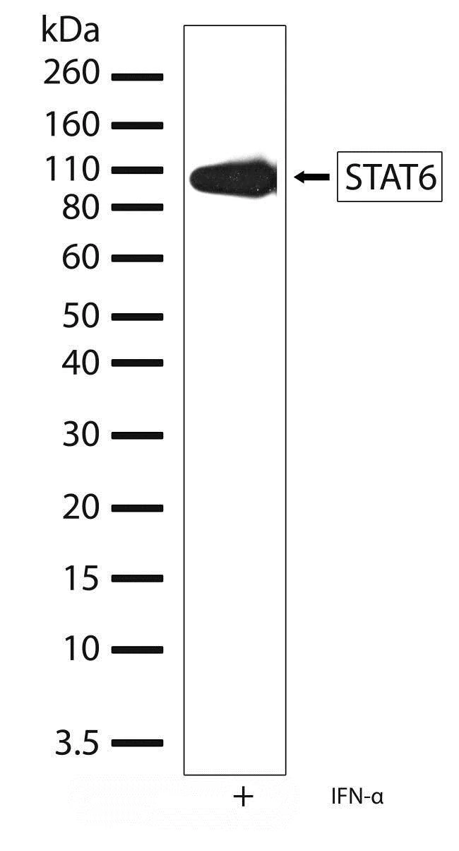 Western blot - Anti-STAT6 antibody [21HCLC] (AB277765)