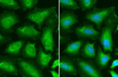 Immunocytochemistry/ Immunofluorescence - Anti-STAT6 antibody (AB227497)
