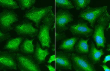 Immunocytochemistry/ Immunofluorescence - Anti-STAT6 antibody (AB227497)