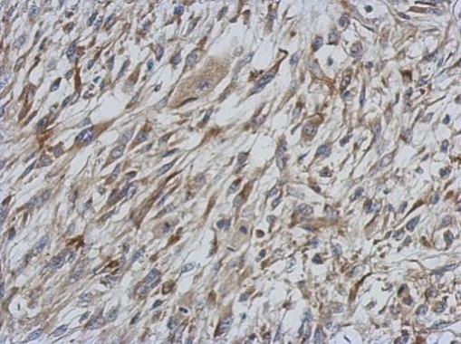 Immunohistochemistry (Formalin/PFA-fixed paraffin-embedded sections) - Anti-STAT6 antibody (AB227497), expandable thumbnail