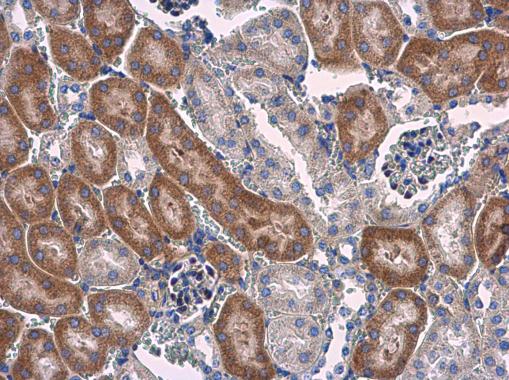Immunohistochemistry (Formalin/PFA-fixed paraffin-embedded sections) - Anti-STAT6 antibody (AB227497), expandable thumbnail