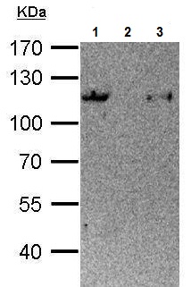 Immunoprecipitation - Anti-STAT6 antibody (AB227497), expandable thumbnail