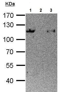 Immunoprecipitation - Anti-STAT6 antibody (AB227497)