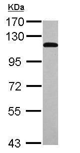 Western blot - Anti-STAT6 antibody (AB227497), expandable thumbnail