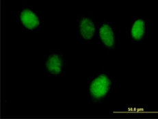 Immunocytochemistry/ Immunofluorescence - Anti-STAT6 antibody (AB88540)