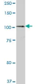 Western blot - Anti-STAT6 antibody (AB88540)