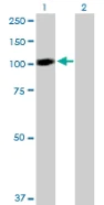 Western blot - Anti-STAT6 antibody (AB88540)