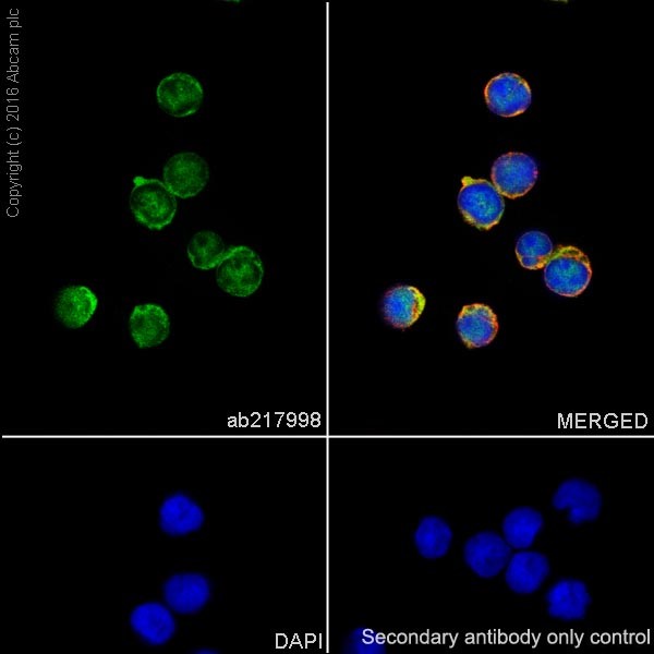 Immunocytochemistry/ Immunofluorescence - Anti-STAT6 antibody [EPR18278-222] (AB217998)