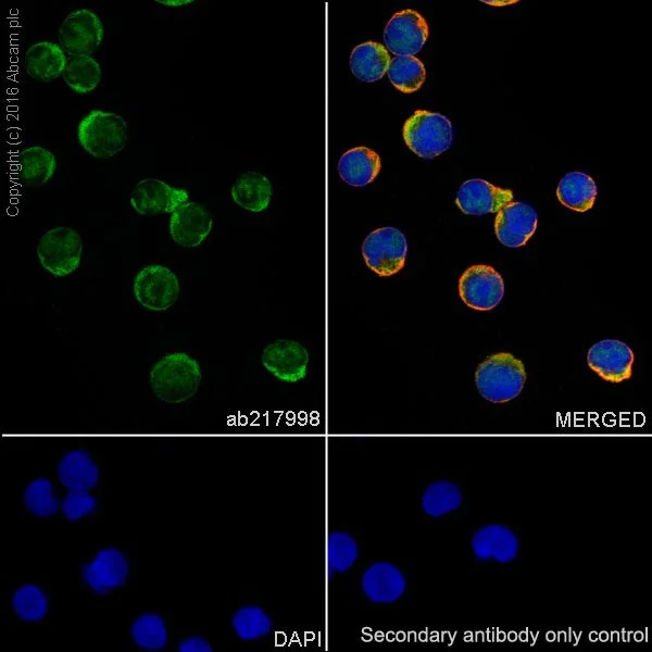 Immunocytochemistry/ Immunofluorescence - Anti-STAT6 antibody [EPR18278-222] - BSA and Azide free (AB251555)
